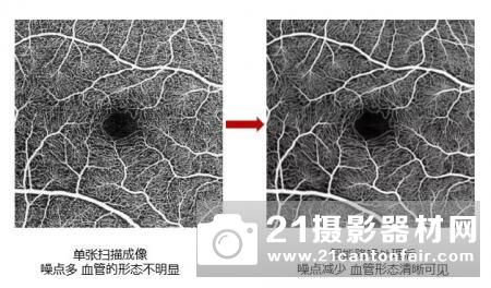 应用AI技术缩短眼底诊疗时间 佳能亮相中华医学会第二十四次全国眼科学术大会